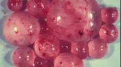 Co to jest echinokokus i jak sobie z nim radzić